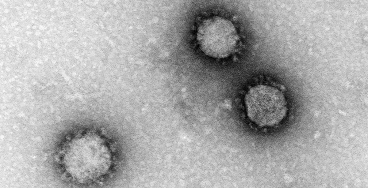 Sars Corona Virus RKI